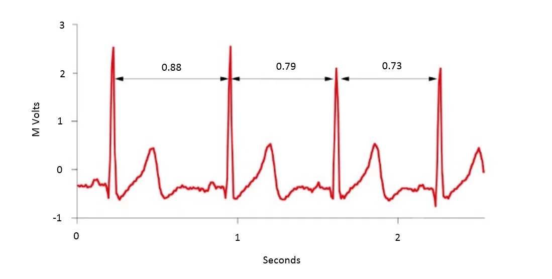 Understanding Heart Rate Variability (HRV) and Its Impact on Athletic Performance